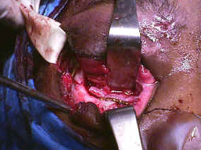 A tree branch causing trauma lying on the floor